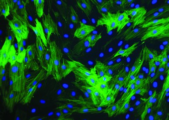 BSMC stained for alpha smooth muscle actin 200X