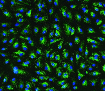 CC-2814 HMVEC-LLy Factor VIII and DAPI