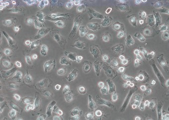 CD14Monocytes_data