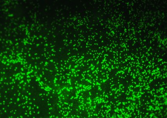 NHBE b-tubulin cilia stain on day 25 post air lift