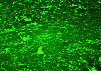 NHOst Day 21 diff stained with OI