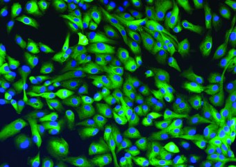 RPEC stained for Pancytokeratin at 20x