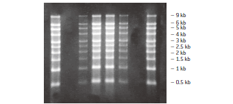 Reliant™ RNA ゲルにおけるRNAマーカーの分離能