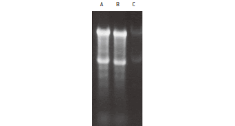GelStar® 染色を使ったRNAの検出
