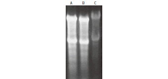 SYBR® Green II 染色によるRNA検出