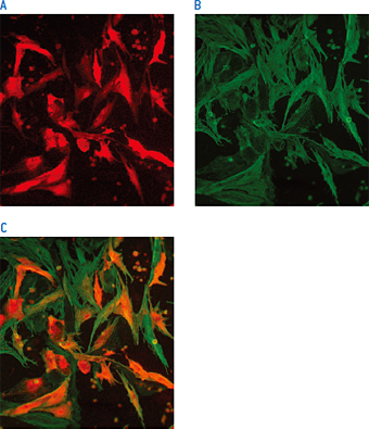 新生児ラット心筋細胞にNucleofection™によりDsRed2のcDNAを導入した例