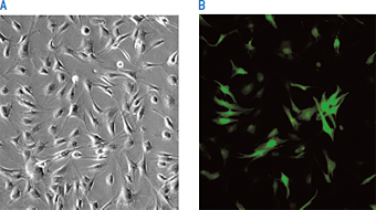 ヒト皮膚線維芽 (成人) 細胞 (NHDF-Ad) へのNucleofection™ によるeGFP発現ベクターの導入例