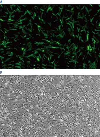 Example of Nucleofection™ of HSMM.