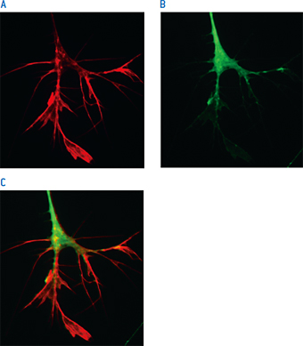 正常な神経成長円錐形成はNucleofection™後の背根神経節の機能が保持されている