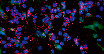 H9細胞はNucleofection™後も多分化能を維持
