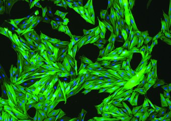 h-intestinal myofibroblast_P2 T-EDTA 30 min alpha SMA